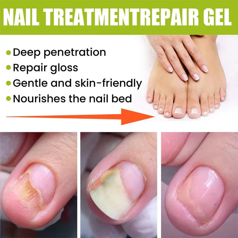 EELHOE - Nail Treatment Repair Gel close-up view - BK Choice UAE